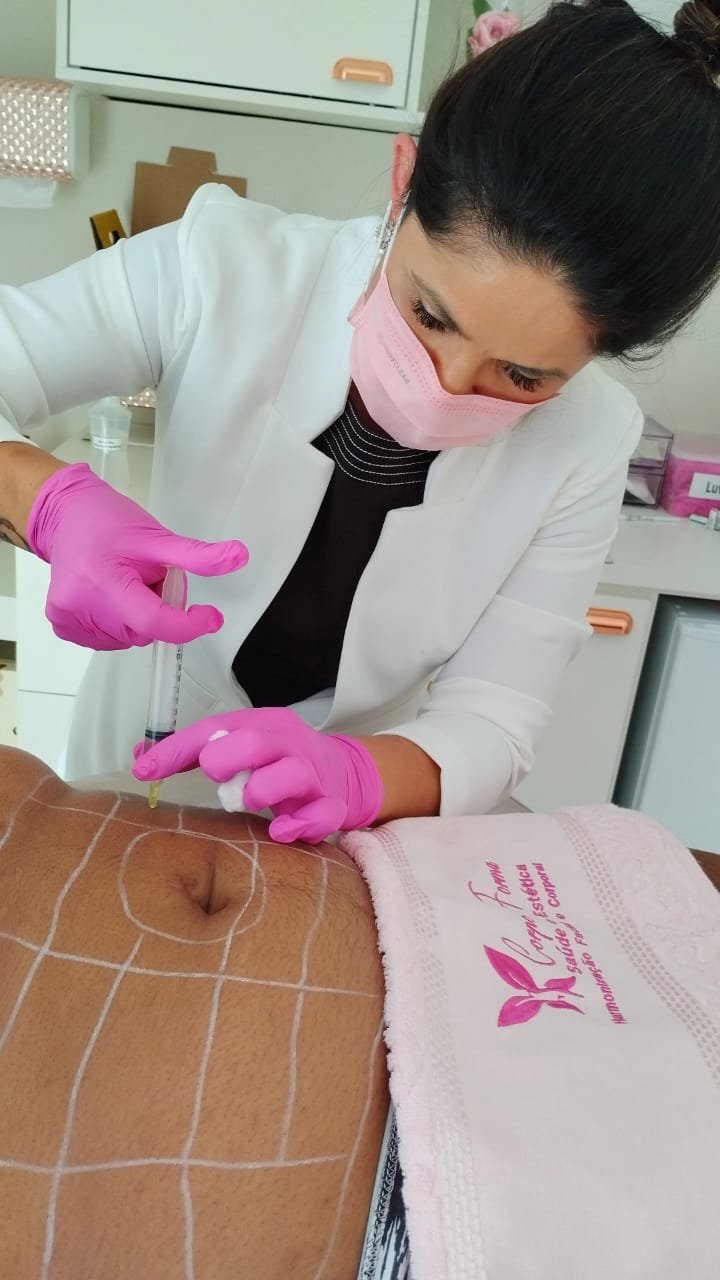 Corpo e Forma Estética Avançada: Transforme seu corpo com a Intradermoterapia 18 Intradermoterapia