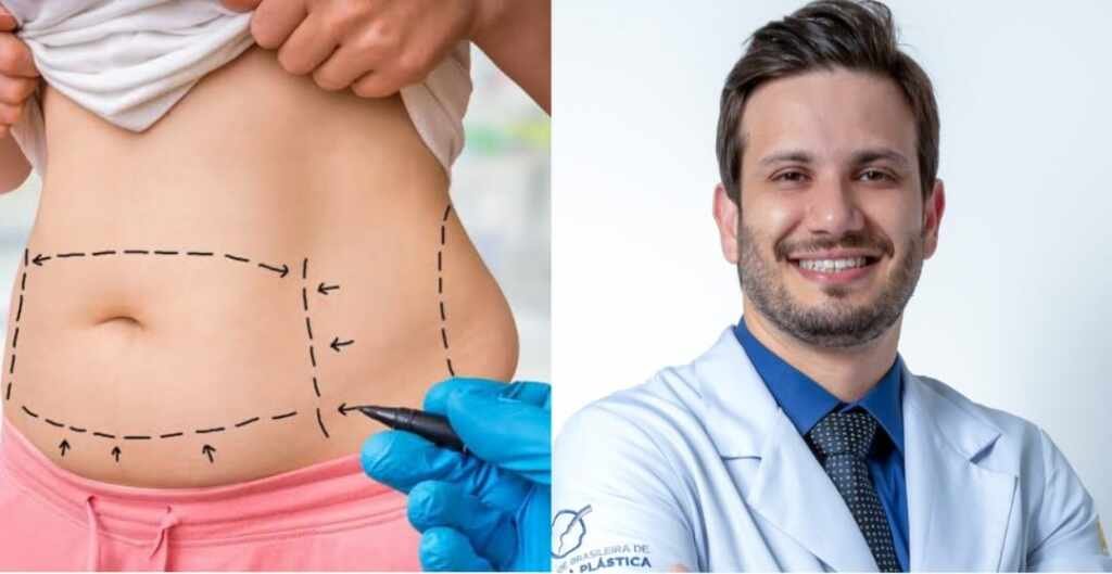 Cirurgias Plásticas combinadas é seguro? Dr. Sérgio Cruz revela receio dos pacientes Cirurgias Plásticas combinadas é seguro? Dr. Sérgio Cruz revela receio dos pacientes
