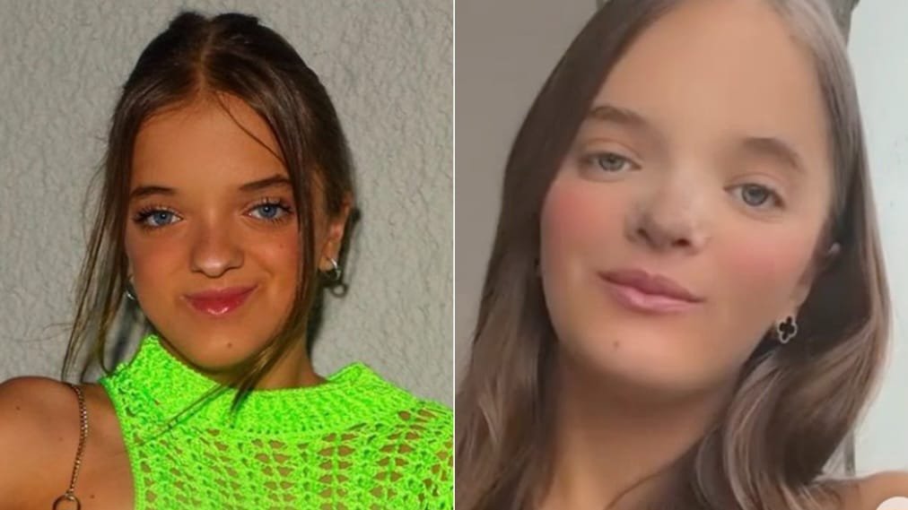 Rinoplastia de Rafaella Justus gera debate sobre pertinência de cirurgias em adolescentes