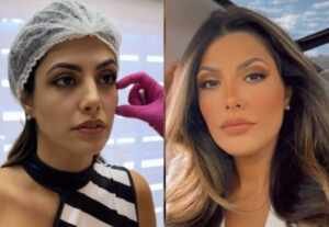 Ex Playboy,  Mary Silvestre faz harmonização facial