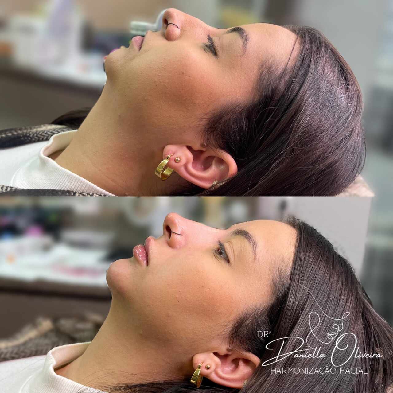 Goioerê Clínica de Estética: Estética avançada perto de você em Moreira Sales 19 3 10 scaled