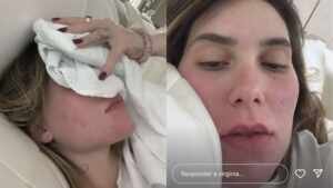 Virginia Fonseca passa mal e relata piora após tomar atitude impulsiva