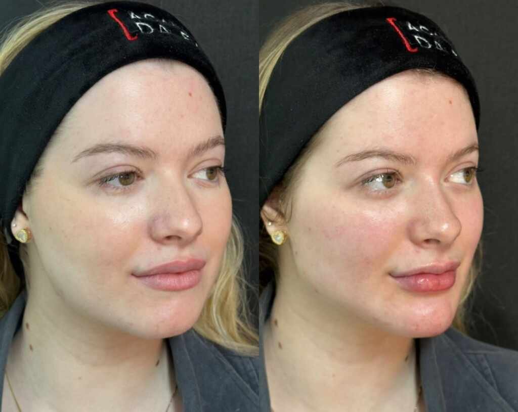 A Fazenda: Conheça o especialista queridinho dos famosos para procedimentos estéticos faciais antes e depois do reality A Fazenda: Conheça o especialista queridinho dos famosos para procedimentos estéticos faciais antes e depois do reality