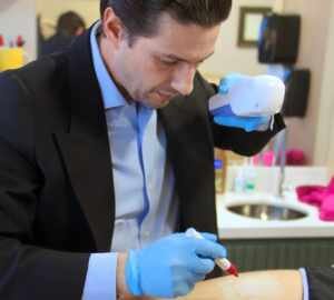 O Impacto do Verão na Saúde Vascular: Cuidados Essenciais com Varizes e Vasos