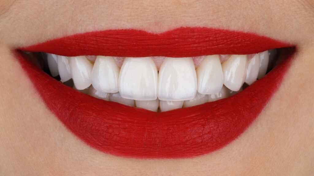 As lentes de contato dental podem corrigir qualquer problema estético? As lentes de contato dental podem corrigir qualquer problema estético?