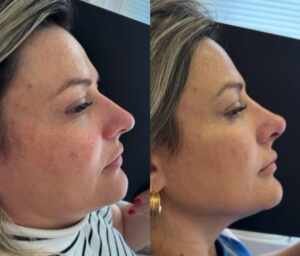 Harmonização Facial: A Arte de Resgatar a Beleza, a Confiança e a Autoestima por Renata Marins 26 e63ca8a3 61a7 49ab 97d3 f83eb382b062 1