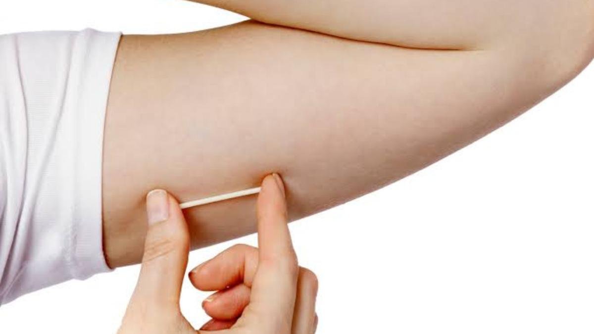 Implantes Hormonais: Praticidade e Eficiência para uma Terapia Hormonal Personalizada 19 WhatsApp Image 2025 01 15 at 10.53.57 1