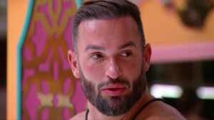 Diego Hypolito fez transplante capilar antes do BBB 25; médico revela detalhes