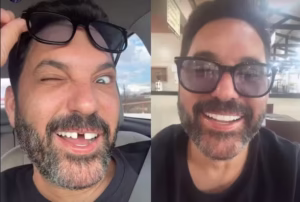 Edson, da dupla com Hudson, perde dente após almoço e faz piada: “Preciso de um dentista em Anápolis!”