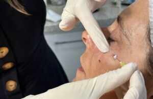 Sinais do Tempo ao redor dos olhos? Veja como a tecnologia estética pode transformar seu olhar