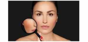 Clareamento de Manchas de Melasma e Virilha: Tratamentos Eficazes e o Que Realmente Funciona