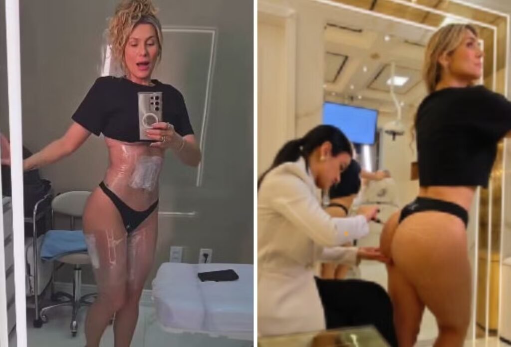 Lívia Andrade revela “combo” de procedimentos estéticos para bumbum e abdômen