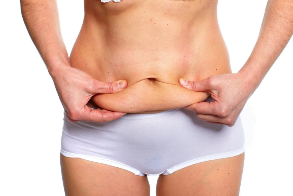 Abdominoplastia pós-bariátrica: especialista detalha como cirurgia moderna reconstrói contorno abdominal Abdominoplastia pós-bariátrica: especialista detalha como cirurgia moderna reconstrói contorno abdominal