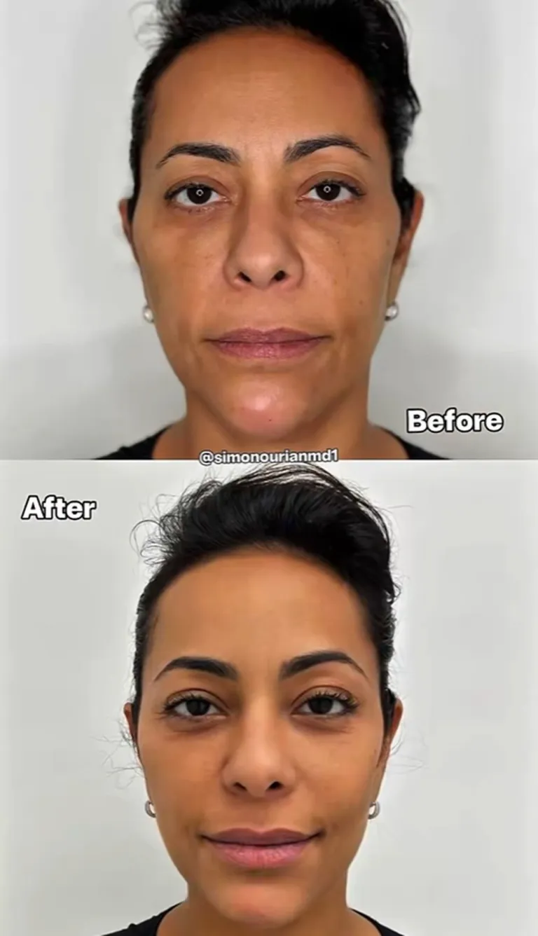 1765286886 271 Samantha Schmutz surpreende ao mostrar resultado de procedimento com medico