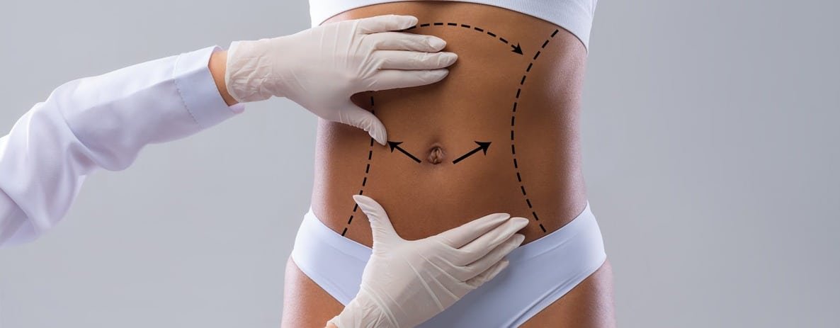 Dr. Octávio Curi Frascareli - A importância da avaliação individual em cirurgia plástica 18 avaliacao medica2
