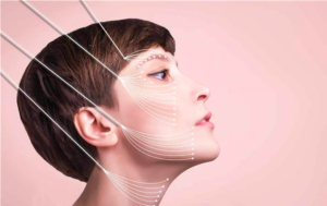 Lifting facial: técnicas modernas redefinem o rejuvenescimento com naturalidade e segurança