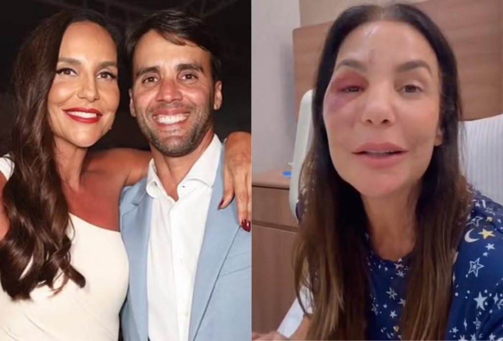 Daniel Cady tranquiliza fãs após cirurgia de Ivete Sangalo: “Foi um susto” 19 Daniel Cady tranquiliza fãs após cirurgia de Ivete Sangalo: “Foi um susto”