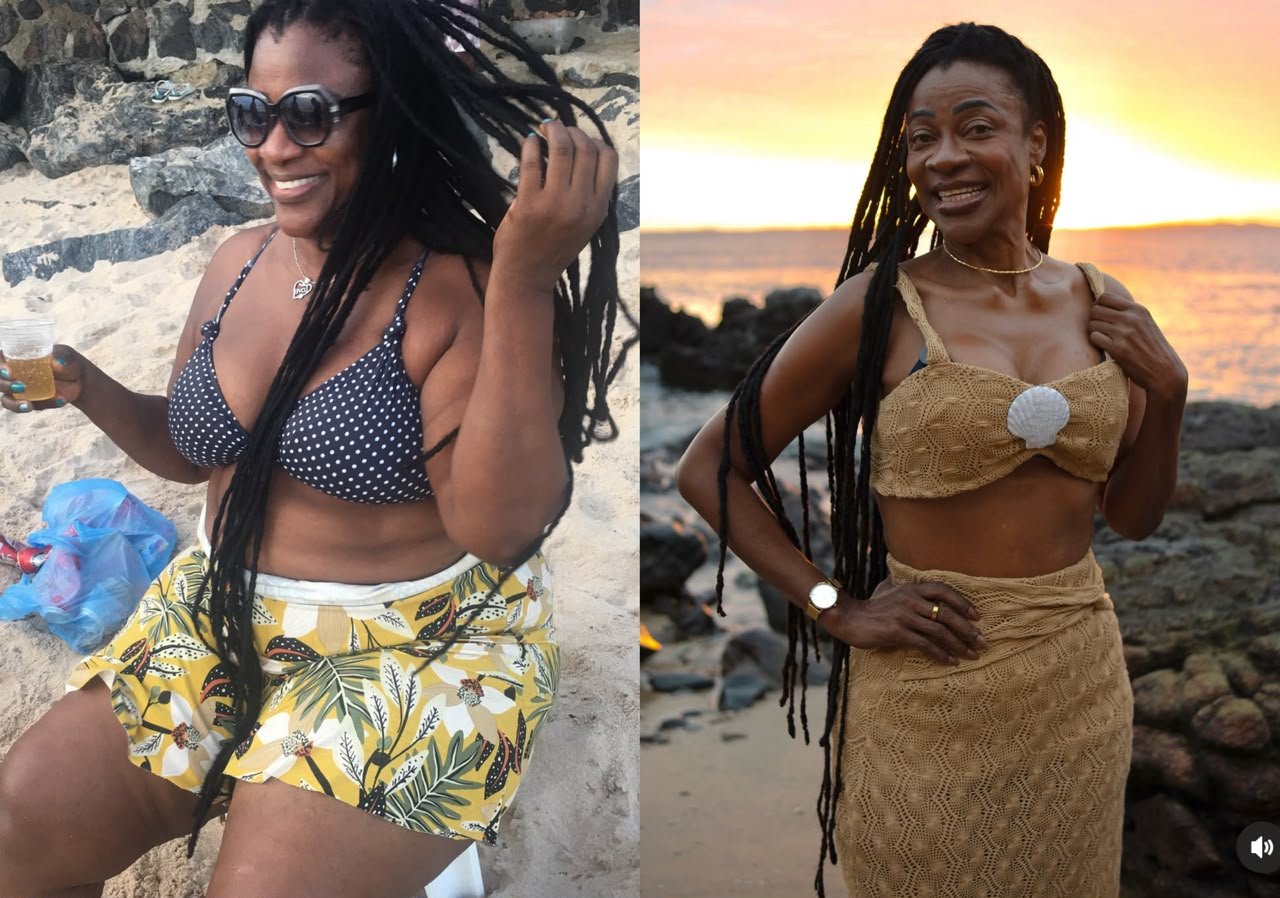O antes e o depois de Claudia Sousa após o médico cirurgião plástico Alexandre Dantas realizar seu sonhoCrédito: Divulgação/ RG PRESS